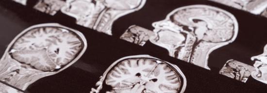 X-ray scan of multiple brains